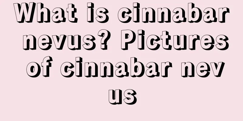 What is cinnabar nevus? Pictures of cinnabar nevus