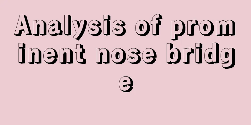 Analysis of prominent nose bridge