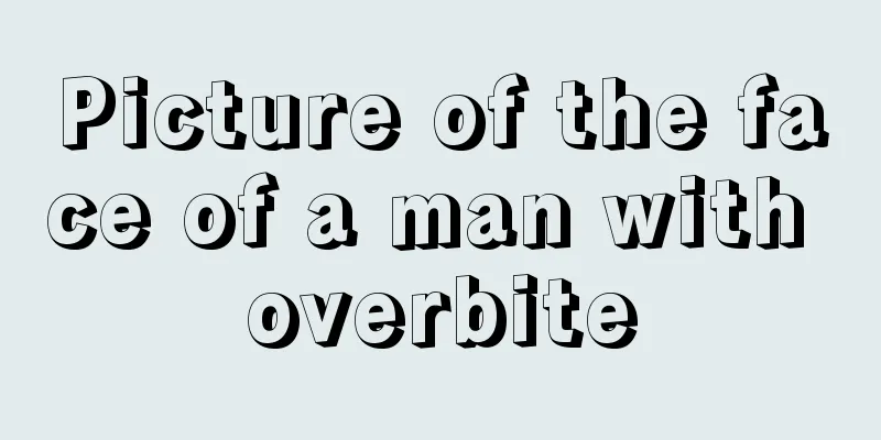 Picture of the face of a man with overbite