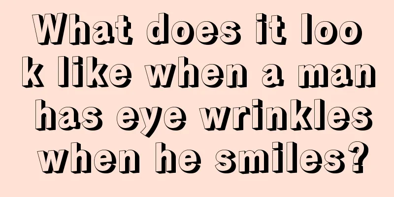 What does it look like when a man has eye wrinkles when he smiles?