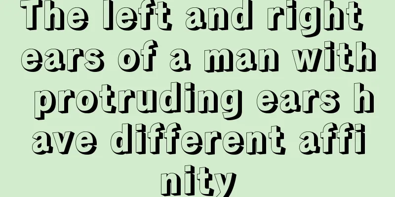 The left and right ears of a man with protruding ears have different affinity