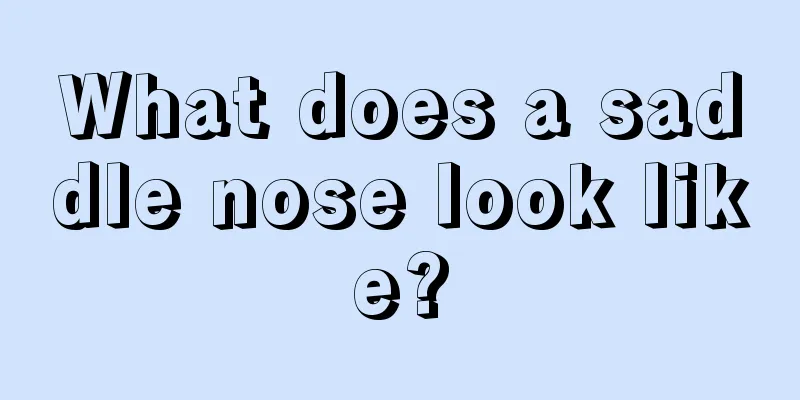 What does a saddle nose look like?
