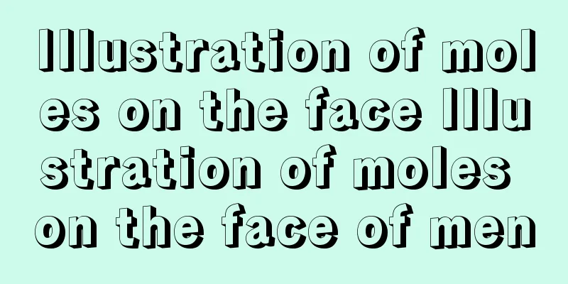 Illustration of moles on the face Illustration of moles on the face of men