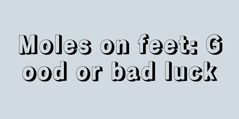 Moles on feet: Good or bad luck