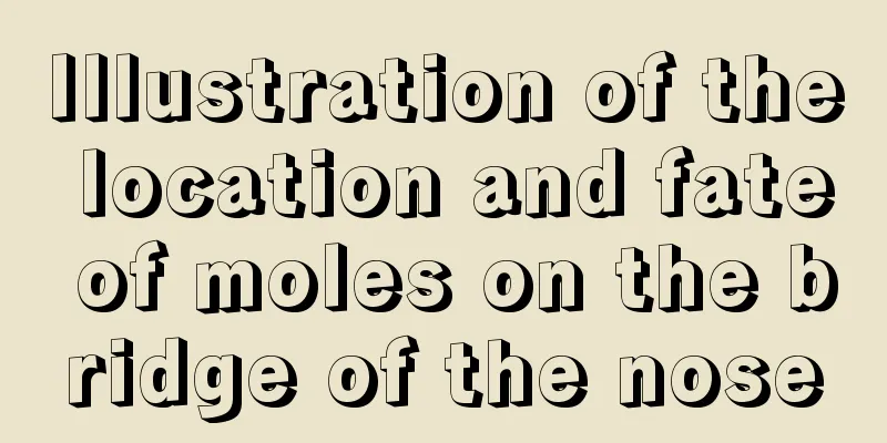 Illustration of the location and fate of moles on the bridge of the nose