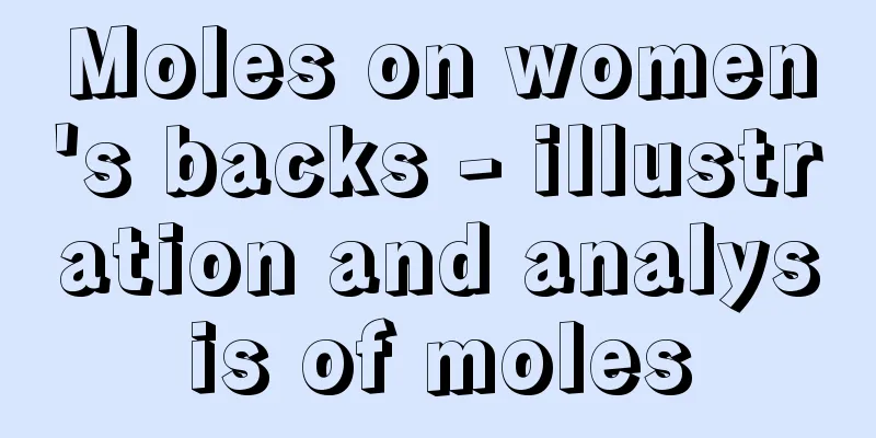 Moles on women's backs - illustration and analysis of moles