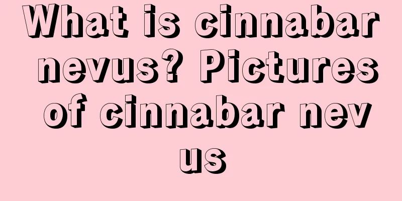 What is cinnabar nevus? Pictures of cinnabar nevus
